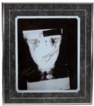 ANGELO DUNDEE AND KEN NORTON SIGNED X-RAY OF MUHAMMAD ALIS BROKEN JAW